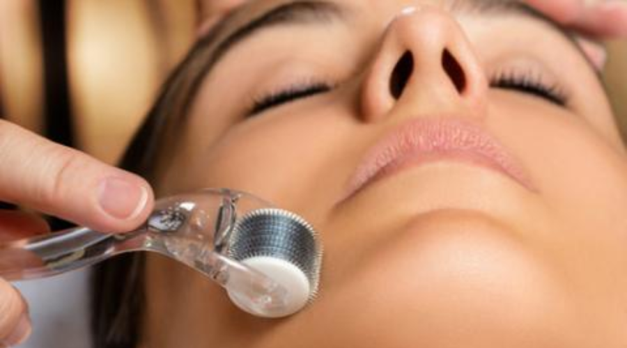skin care after microneedling