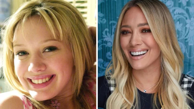 Hollywood Grins: The Rise of the Gummy Smile